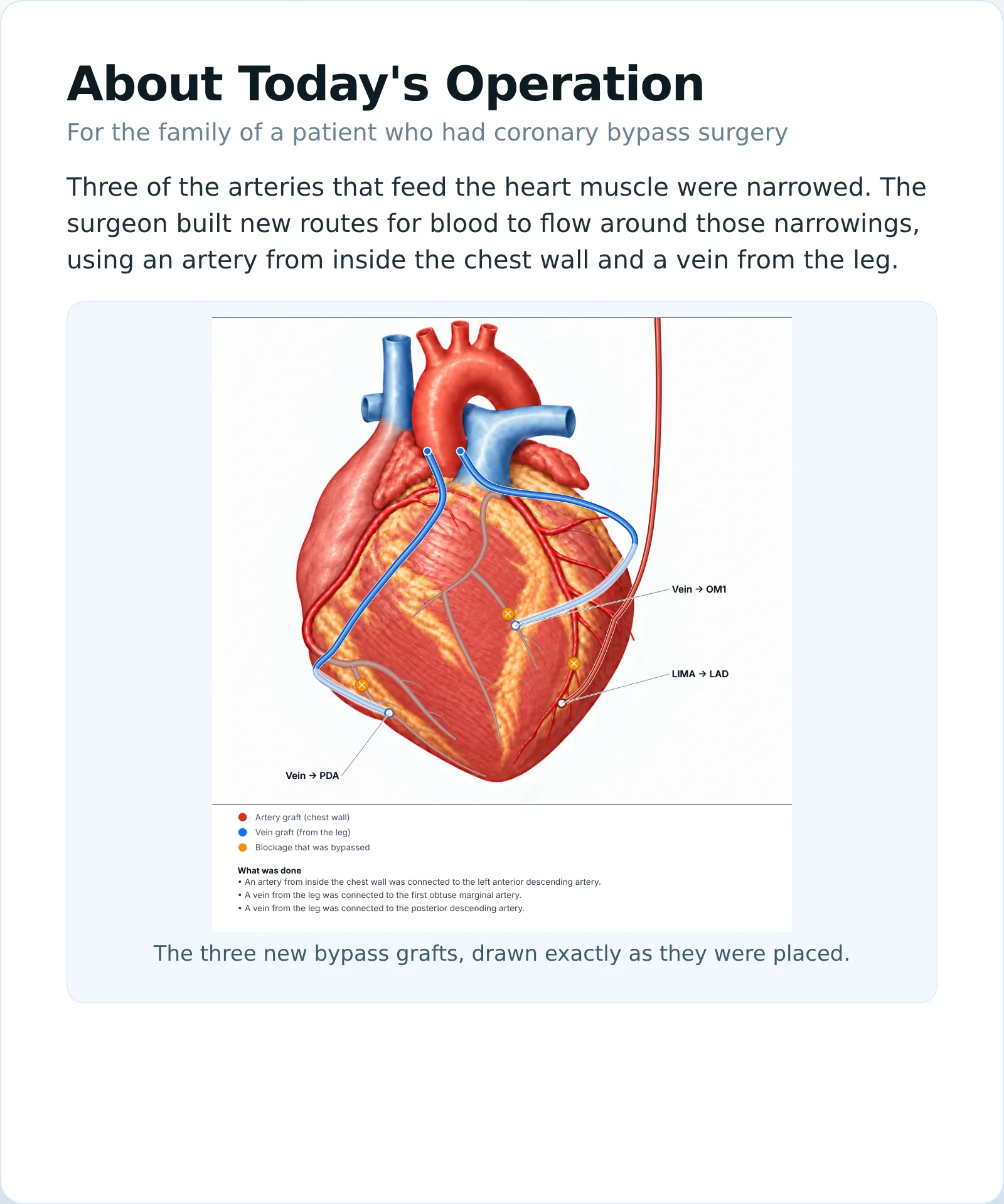 A printed MyOpNote Family Report: 'About Today's Operation' with a plain-language summary and a picture of three bypass grafts on the heart